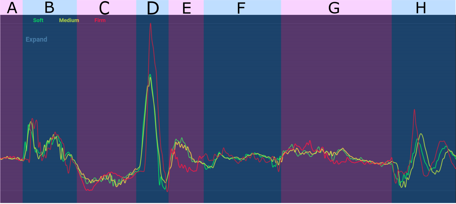 Acceleration graph